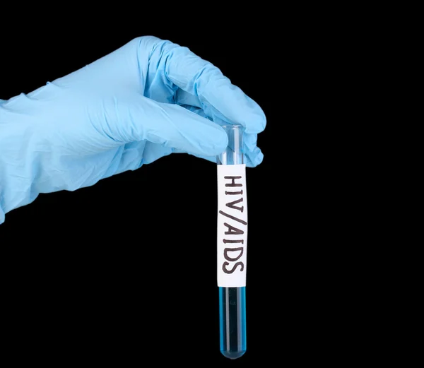 Test tube labeled HivAids in hand isolated on black — Stock Photo, Image