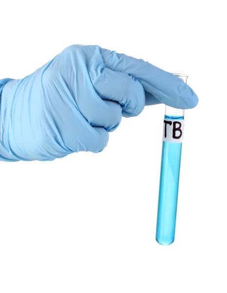 Test tube labeled Tuberculosis(TB) isolated on white — Stock Photo, Image