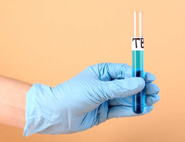 Reageerbuis label Tuberculosis(Tb) in hand op beige achtergrond — Stockfoto