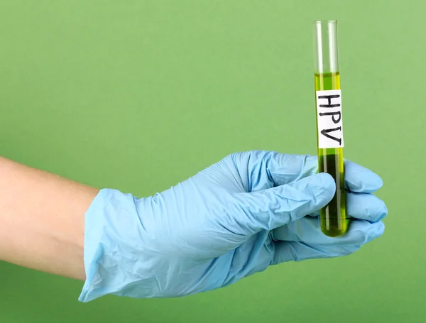 Tubul de testare etichetat uman — Fotografie, imagine de stoc