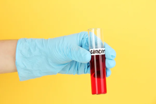 Test tube labeled Cancer in hand on yellow background — Stock Photo, Image