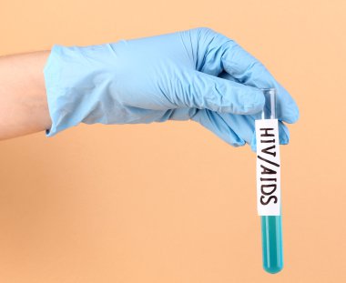 hivaids el bej renkli arka plan üzerinde deney tüpü etiketli
