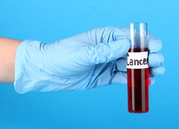 Tubo de teste rotulado Câncer na mão sobre fundo azul — Fotografia de Stock
