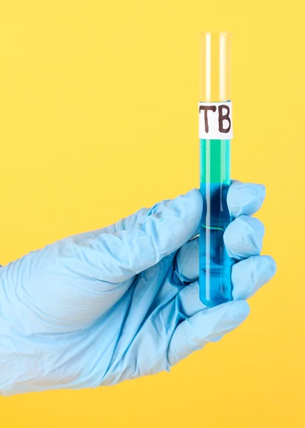 Reageerbuis label Tuberculosis(Tb) in hand op gele achtergrond — Stockfoto