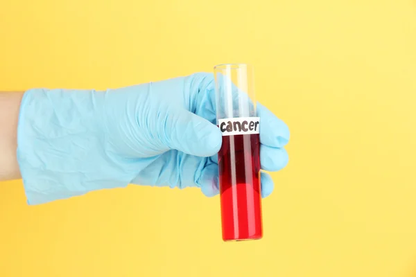 Tubo di prova etichettato Cancro in mano su sfondo giallo — Foto Stock
