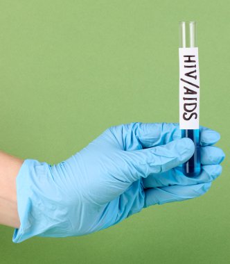 Yeşil arkaplanda HivAids etiketli test tüpü