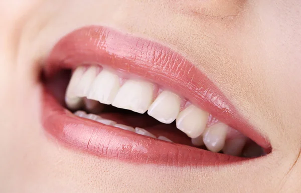 Mulher sorrindo com os dentes isolados no fundo branco — Fotografia de Stock