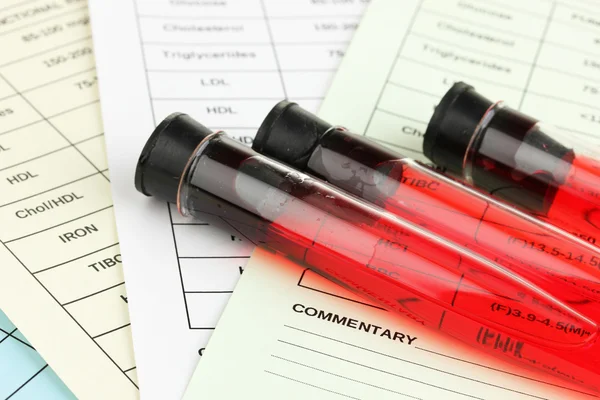 Blood in test tubes and results close up — Stock Photo, Image