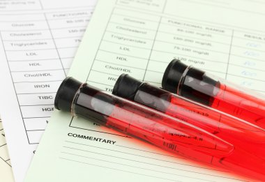 Test tüplerindeki kan ve sonuçlar kapanıyor.