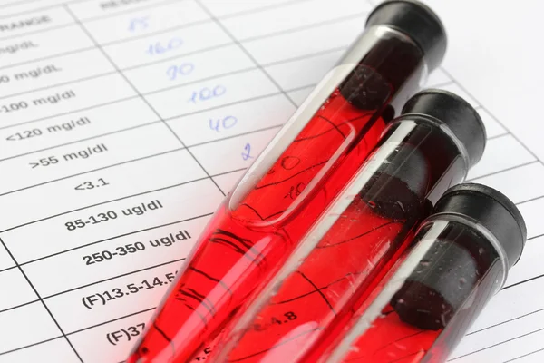 Blood in test tubes and results close up — Stock Photo, Image