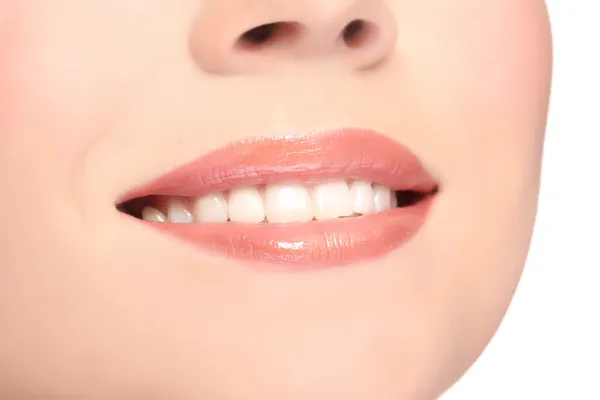 흰색 배경에 고립 된 치아와 함께 웃는 여자 — 스톡 사진