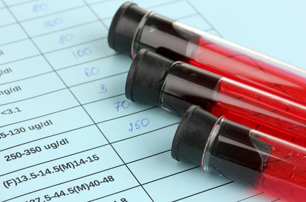 Blood in test tubes and results close up Royalty Free Stock Photos