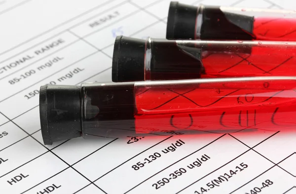 Blood in test tubes and results close up — Stock Photo, Image