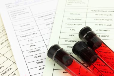 Test tüplerindeki kan ve sonuçlar kapanıyor.