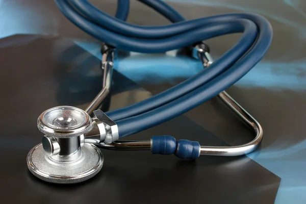 Medical stethoscope on an x-ray picture close up — Stock Photo, Image