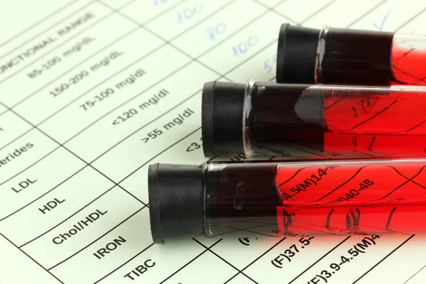 Sangre en los tubos de ensayo y resultados de cerca — Foto de Stock