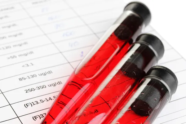 Blood in test tubes and results close up — Stock Photo, Image