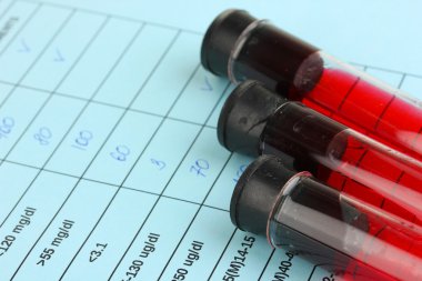 Test tüplerindeki kan ve sonuçlar kapanıyor.