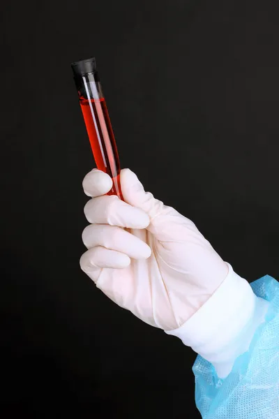Skleněná trubička s tekutinou v ruce vědec během lékařské zkoušky na černém pozadí — Stock fotografie