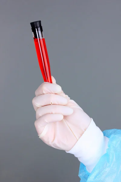 Γυάλινο σωλήνα με ρευστό στο χέρι επιστήμονας κατά ιατρική δοκιμή σε γκρι φόντο — Φωτογραφία Αρχείου