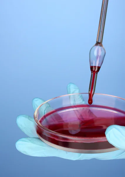 Pipetta da laboratorio con goccia di liquido chimico sopra la capsula di Petri con soluzione colorata media in mano da scienziato, da vicino, su fondo colore — Foto Stock