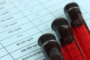 Test tüplerindeki kan ve sonuçlar kapanıyor.