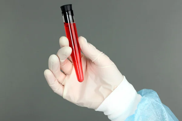 Tubo de vidro com fluido na mão do cientista durante o teste médico em fundo cinza — Fotografia de Stock
