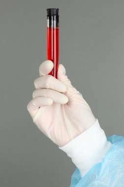 cam tüp sıvı gri arka plan üzerinde tıbbi test sırasında bilim adamı elinde olan