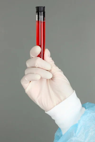 Tubo de vidro com fluido na mão do cientista durante o teste médico em fundo cinza — Fotografia de Stock