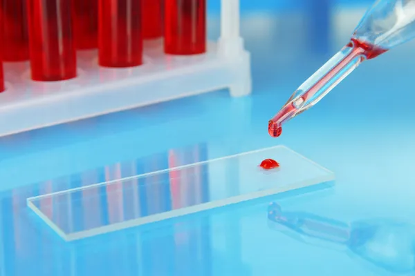 Provette con sangue in laboratorio su fondo blu — Foto Stock