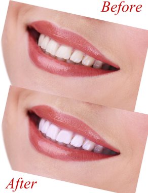 dişleri yakın çekim ile gülümseyen kadın