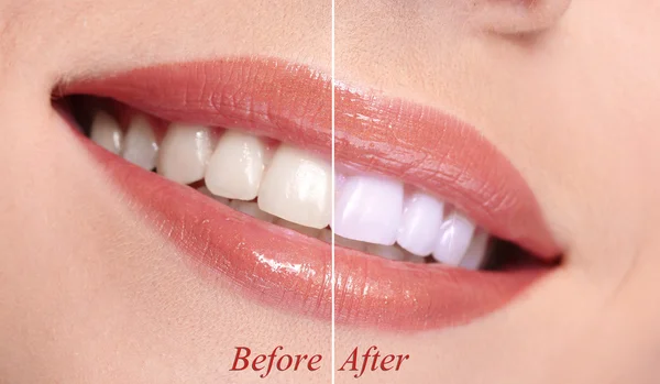 Frau lächelt mit Zähnen aus nächster Nähe — Stockfoto