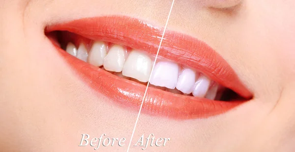 Woman smiling with teeth close-up — Stock Photo, Image