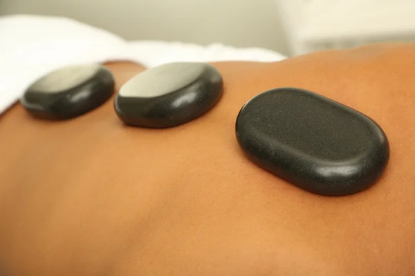 Heiße Steine auf dem Rücken vor der Massage aus nächster Nähe — Stockfoto