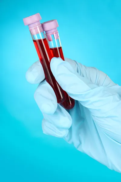 Reagenzgläser mit Blut in der Hand auf blauem Hintergrund — Stockfoto