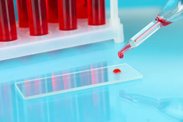 Provette con sangue in laboratorio su fondo blu — Foto Stock