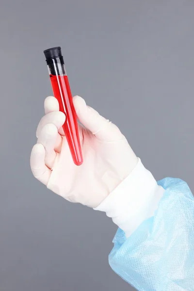 Cam tüp sıvı gri arka plan üzerinde tıbbi test sırasında bilim adamı elinde olan — Stok fotoğraf
