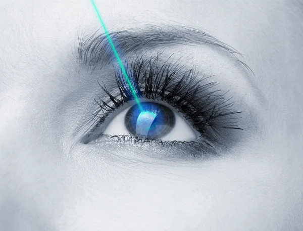 Laser vision correction. Woman's eye. — Stock Photo, Image