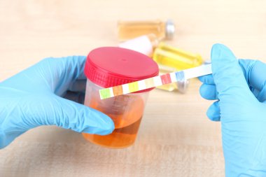 check-up. şeritler sağlık raporu ve idrar testi