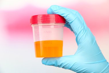 Medical urine test, close-up clipart