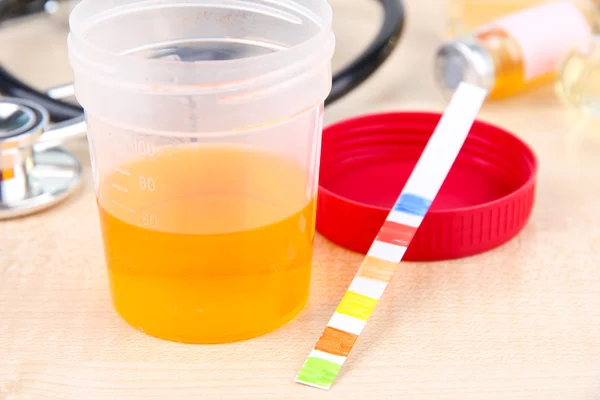 Check-up. Rapport médical et bandelettes d'analyse d'urine — Photo