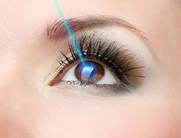 Laser vision correction. Woman's  eye. — Stock Photo, Image