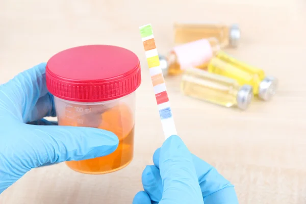 Check-up. Medical report and urine test strips — Stock Photo, Image