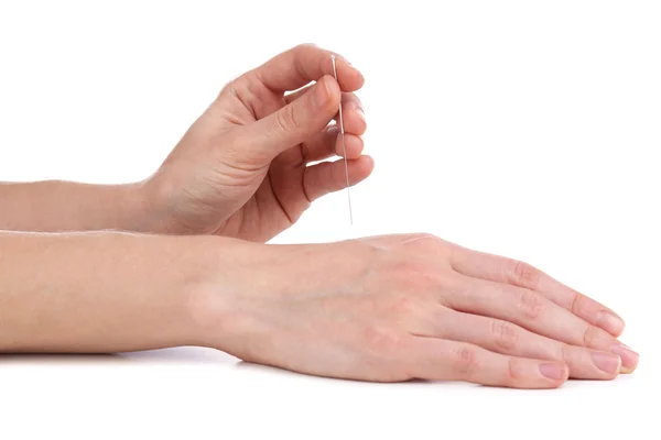Agopuntura a portata di mano, da vicino. Isolato su bianco — Foto Stock