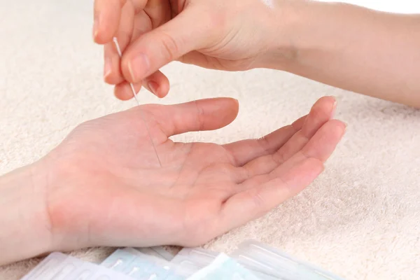 Akupunktur zur Hand, hautnah. isoliert auf weiß — Stockfoto
