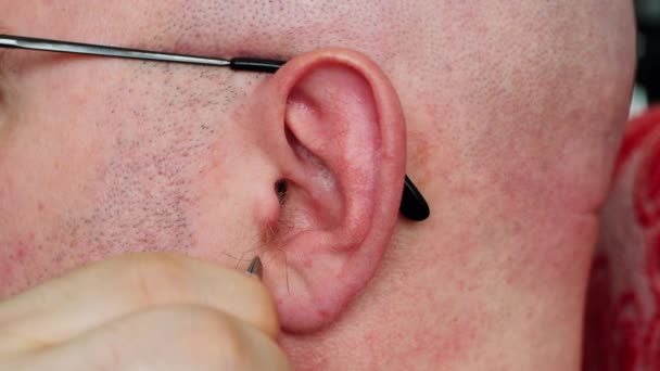一个戴眼镜的秃头男人用镊子把自己的长发从他的耳朵上移开 身体护理 卫生程序 整容手术化妆和打扮 人类的耳朵新剃光的男性头和面颊 后续行动 — 图库视频影像