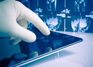 tıbbi mavi eldiven x-ray görüntüleri arka plan üzerinde modern dijital tablet dokunmadan el