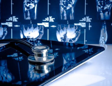 Laboratuvarda röntgen görüntüleri arka plan üzerinde modern dijital tablet sağlık stetoskop