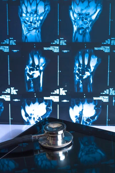 Stethoscoop op digitale tablet pc in laboratorium op x-ray beelden achtergrond — Stockfoto