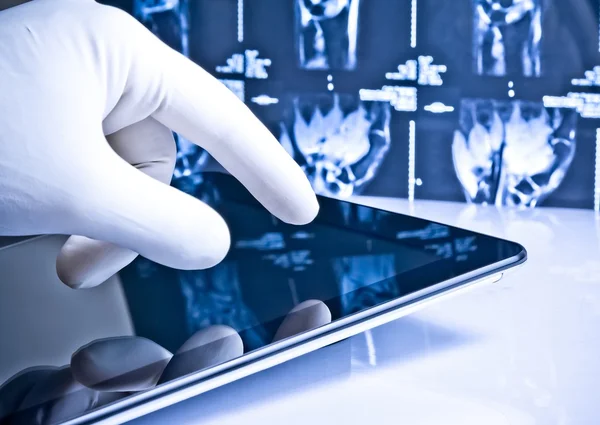 Mano en guante médico tocando tableta digital moderna en fondo de imágenes de rayos X — Foto de Stock